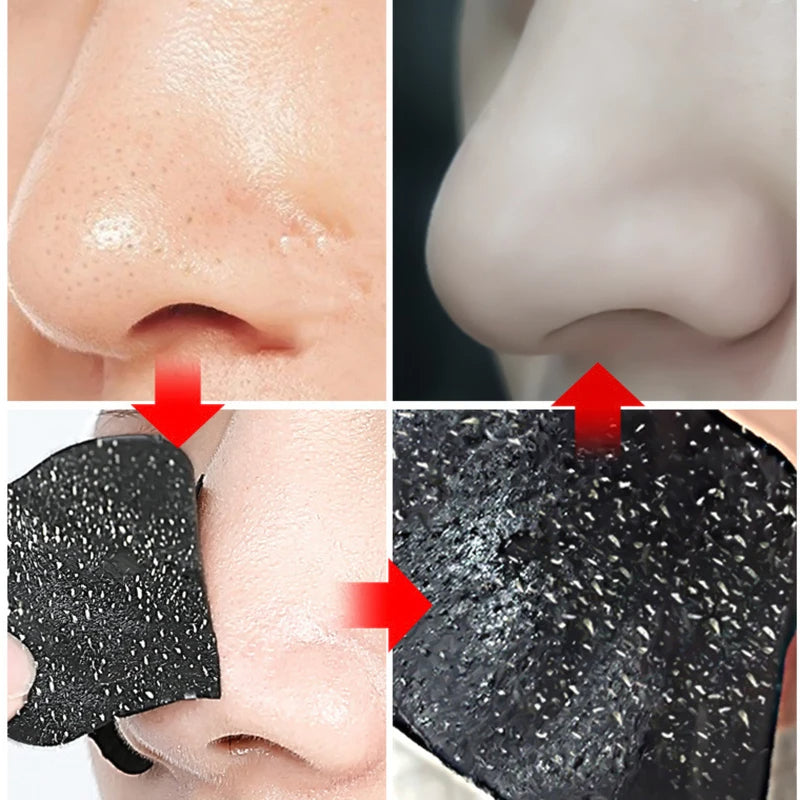 Charcoal Nose Strips