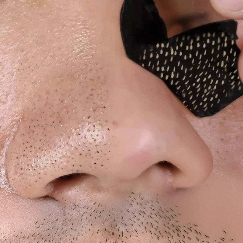 Charcoal Nose Strips